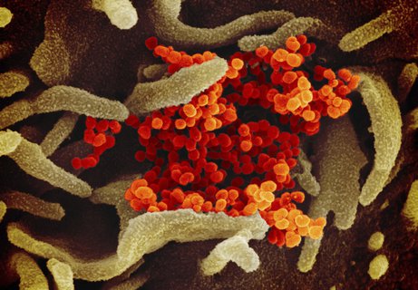 Diese rasterelektronenmikroskopische Aufnahme zeigt eine Ansammlung von Exemplaren des neuartigen Coronavirus in einer Zellkultur in den USA. Das von einemPatienten in den USA isoliete Virus (orange) tritt aus der Oberfläche von im Labor kultivierten Zellen (grün). Der Erreger trägt die wissenschaftlichen Namen SARS-CoV-2 oder auch 2019-nCoV.