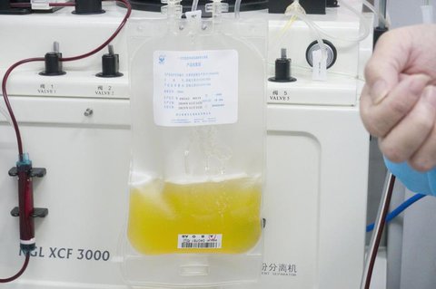 Gespendetes Plasma eines geheilten Coronavirus-Patienten wird in einem 
Plasmabeutel aufgefangen.