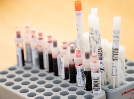  Abstrichtests und Blutproben: In Kupferzell sollen Bewohner auf Antikörper untersucht werden. 