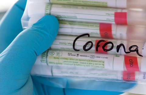 Proben für Corona-Tests.