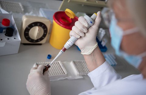 Eine Blutprobe wird auf Antikörper untersucht.