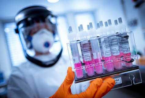 Die Zahl positiver Tests bleibt auf hohem Niveau.